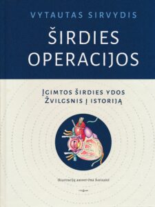 Širdies operacijos : įgimtos širdies ydos : žvilgsnis į istoriją / Vytautas Sirvydis ; iliustracijų autorė Ona Barisaitė. Vilnius : Tyto alba, 2021. 327, [1] p..